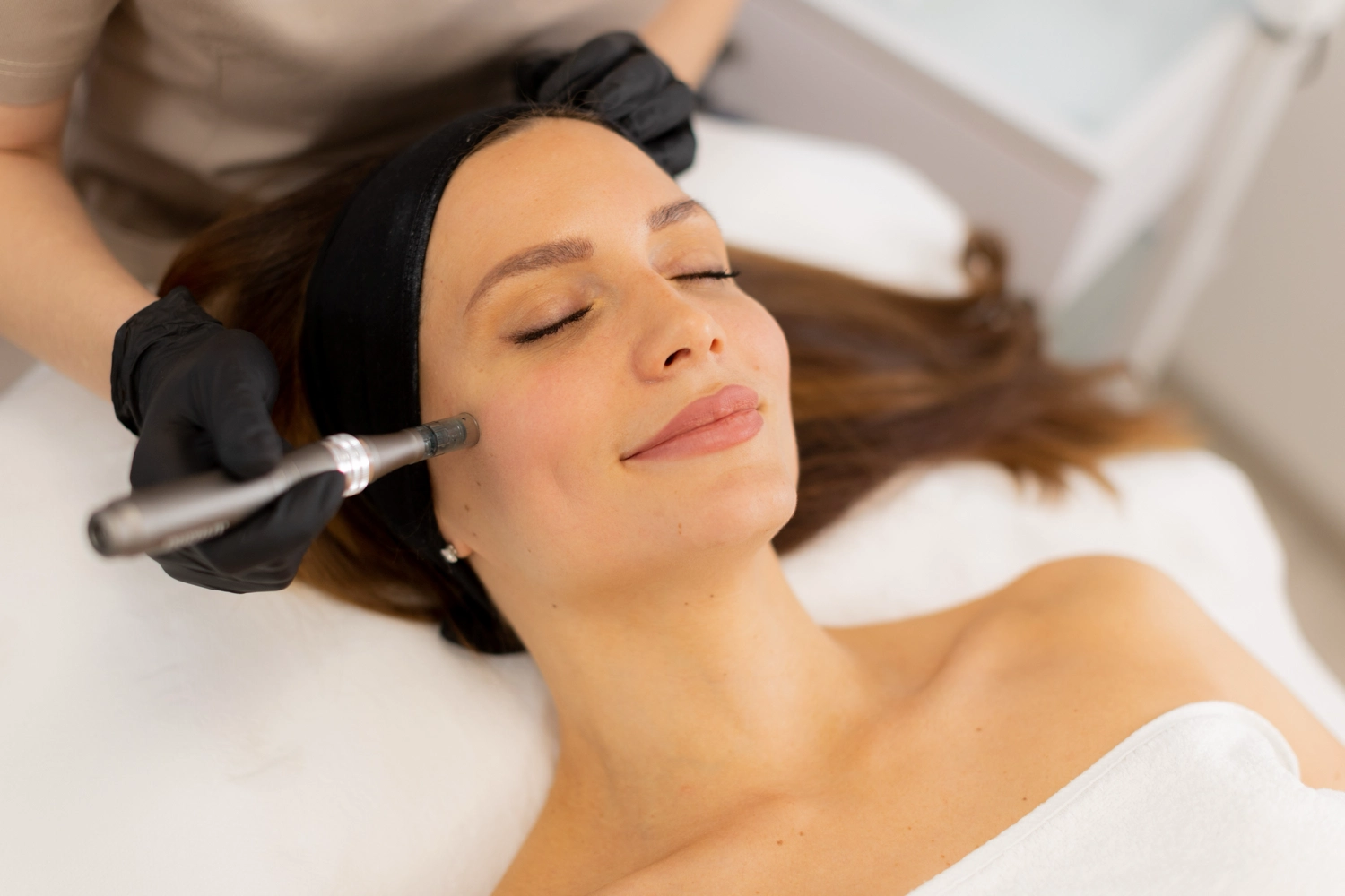 Microneedling Droitwich - Aesthetics by Hannah